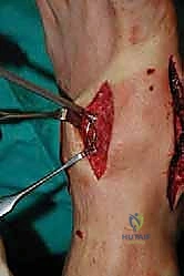 Clinical Image