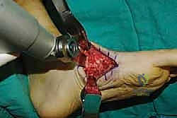 Clinical Image