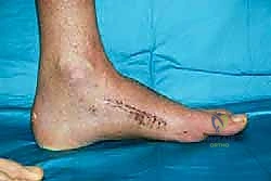 Clinical Image