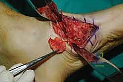 Clinical Image