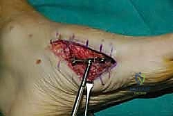 Clinical Image