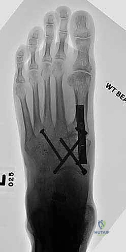 Clinical Image