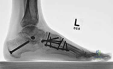 Clinical Image