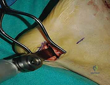 Clinical Image