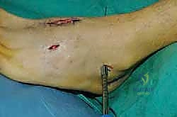 Clinical Image