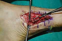 Clinical Image
