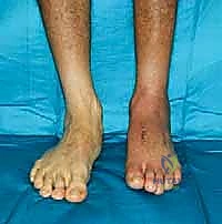 Clinical Image