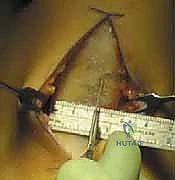 عوامل الخطر التشريحية