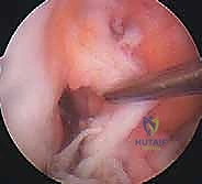 أنواع الطعوم المختلفة