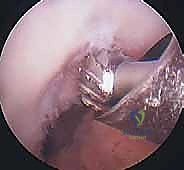 الاستعداد للتدخل الجراحي