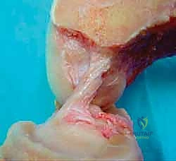 الأستاذ الدكتور محمد هطيف أثناء الجراحة