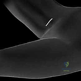 دليل شامل لأمراض وإصابات العظام والمفاصل: العمود الفقري، الطب الرياضي، وجراحة المفاصل الصناعية | الأستاذ الدكتور محمد هطيف، صنعاء