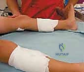 تفاصيل تشريحية لعضلة الساق والتدخل الجراحي