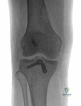 Clinical Image