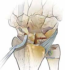 Clinical Image