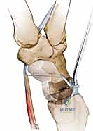 Clinical Image