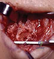 Clinical Image