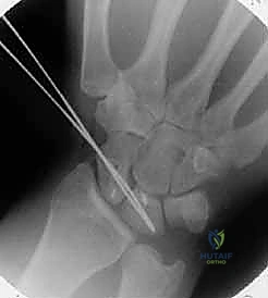 Clinical Image
