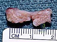 Clinical Image