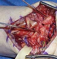 Clinical Image