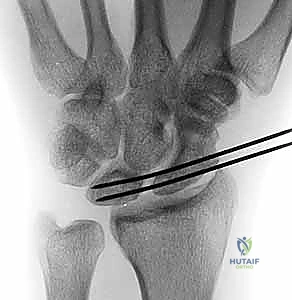 Clinical Image
