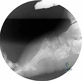 تحديات الجراحة التقليدية ومخاطرها
