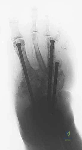 مراحل التقييم السريري والإشعاعي
