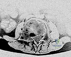 مرحلة التشخيص والتخطيط الطبي