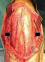 التعقيم الدقيق والتخطيط الجراحي