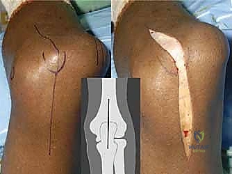 تجهيز المريض في غرفة العمليات