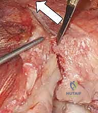 التأكد من استقرار المفصل التجريبي