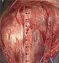 تقييم نطاق الحركة أثناء الجراحة