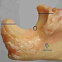 مراجعة الأشعة النهائية داخل العمليات