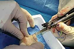 Clinical Image