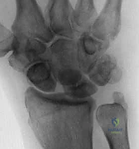 استخدام التنظير أو الأدوات الدقيقة في التشخيص والعلاج