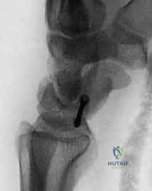 Clinical Image