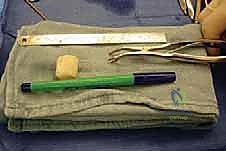 صورة توضيحية لـ إطالة العمود الجانبي للقدم: حل جراحي متقدم لتشوه القدم المسطحة المكتسبة مع الأستاذ الدكتور محمد هطيف