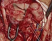 Clinical Image
