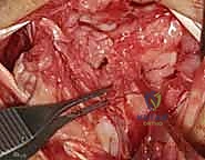 Clinical Image