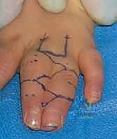 العلاج الطبيعي وإعادة التأهيل