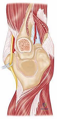 Clinical Image