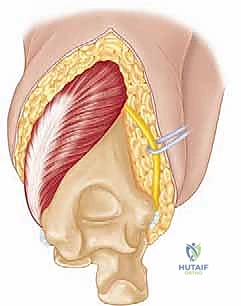 Clinical Image