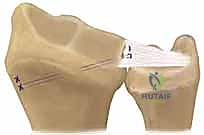 Clinical Image
