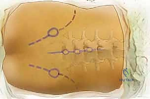 التشريح المعقد للعمود الفقري الخلفي