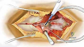 أهمية التشخيص الدقيق قبل الجراحة