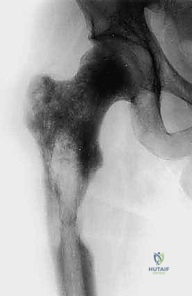 Clinical Image