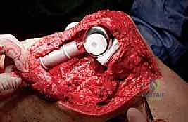 Clinical Image