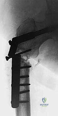 Clinical Image
