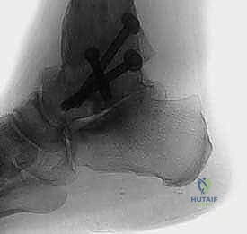 وصف طبي دقيق للمريض