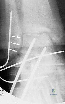 Clinical Image